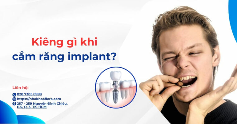 kiêng gì khi cắm răng implant