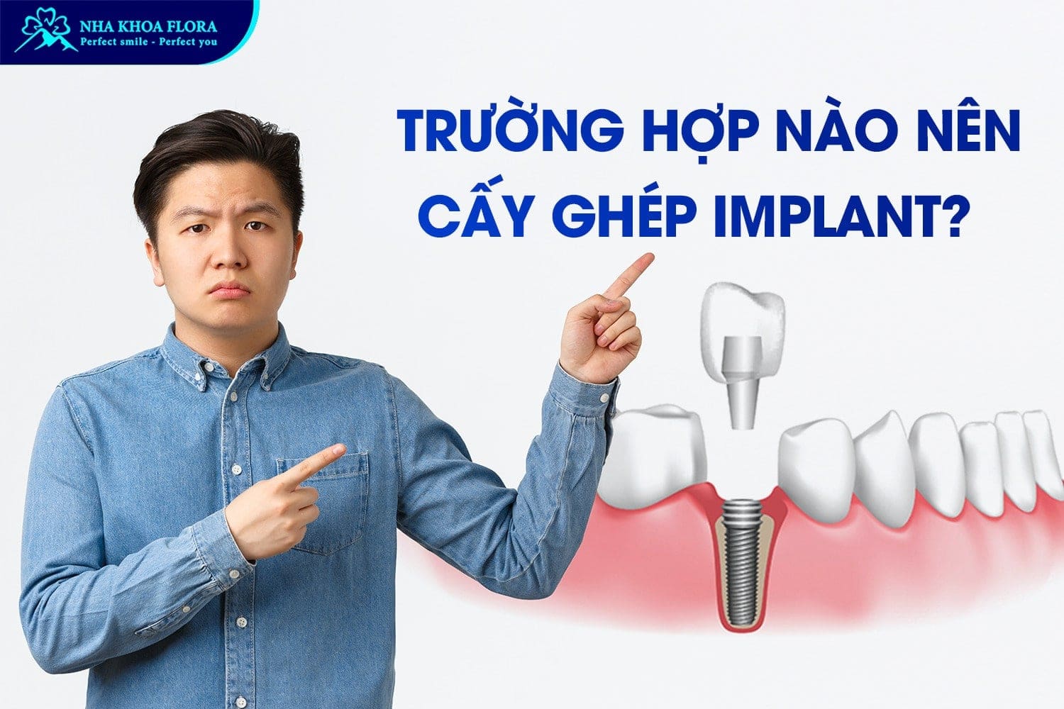 Bỏ Túi 9 Kinh Nghiệm Trồng Răng Implant Hiệu Quả - ảnh 1