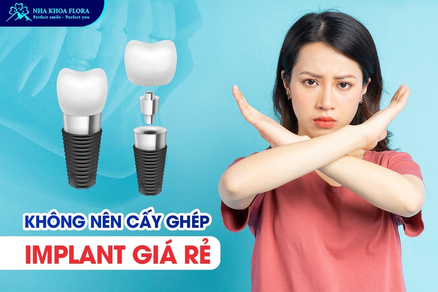 Bỏ Túi 9 Kinh Nghiệm Trồng Răng Implant Hiệu Quả - ảnh 4