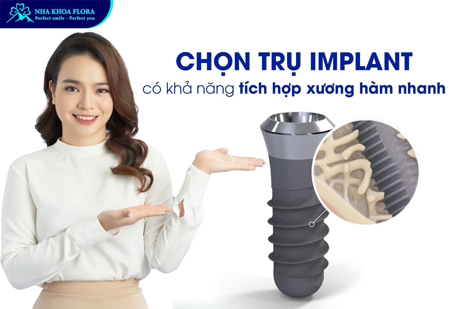 Hỏi Đáp: Trồng Răng Implant Bao Lâu Thì Lành? - ảnh 4
