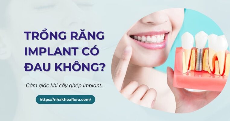 Trồng răng Implant có đau không