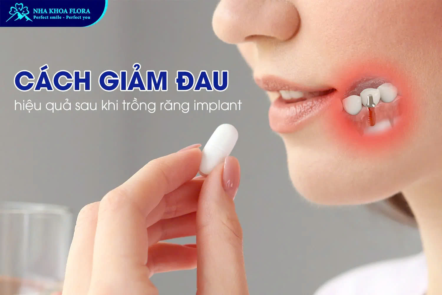 Cách giảm đau hiệu quả sau khi trồng răng implant