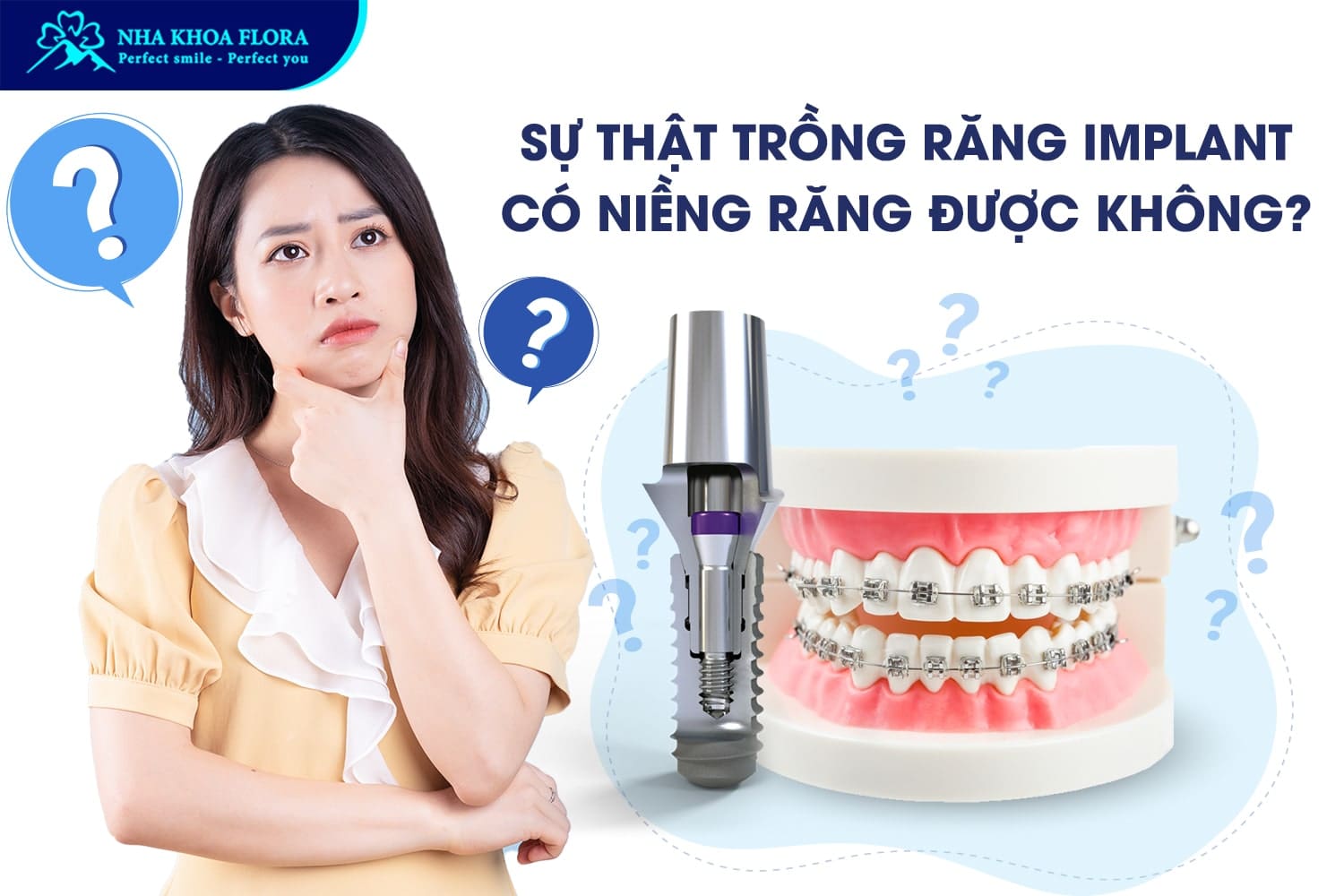 Trồng Răng Implant Có Niềng Răng Được Không? - ảnh 3
