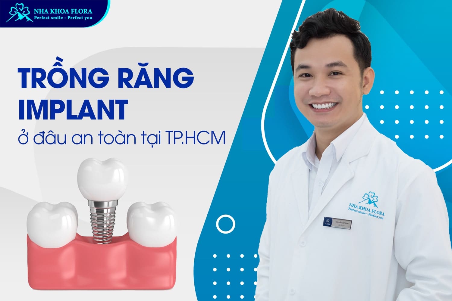 Hỏi Đáp: Trồng Răng Implant Có Vĩnh Viễn Không? - ảnh 5