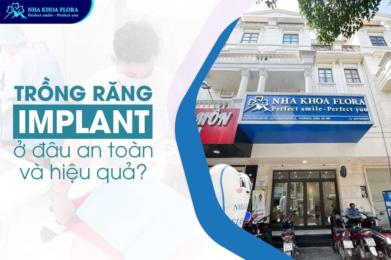 Trồng Răng Implant Là Gì? 10 Điều Cần Biết Trước Khi Thực Hiện - ảnh 5