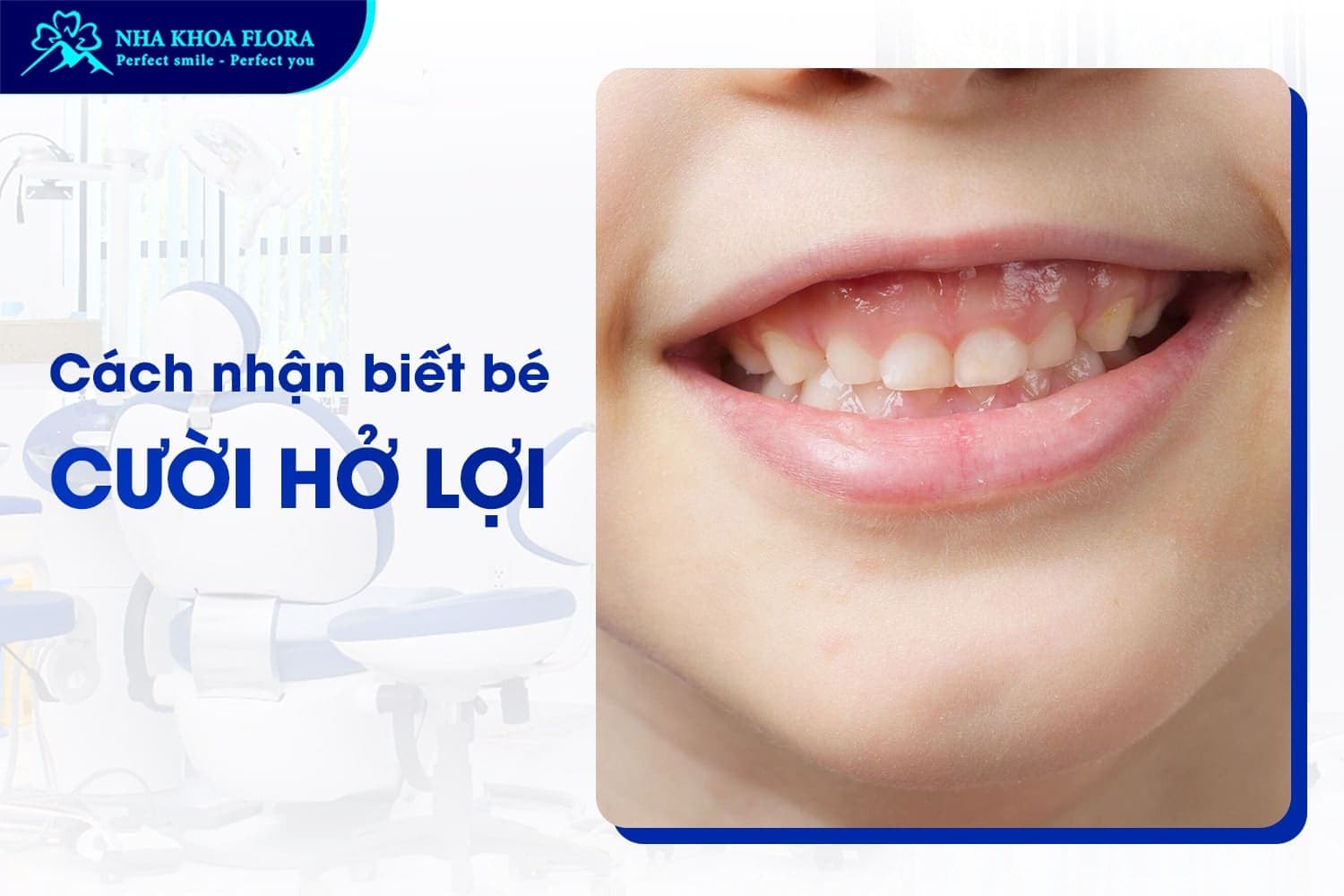 Bé Cười Hở Lợi Có Sao Không? Có Nên Khắc Phục Sớm? - ảnh 1