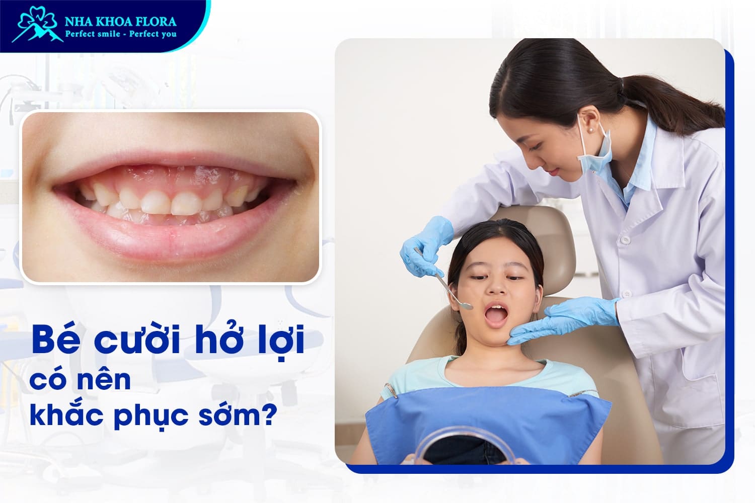 Bé Cười Hở Lợi Có Sao Không? Có Nên Khắc Phục Sớm? - ảnh 3