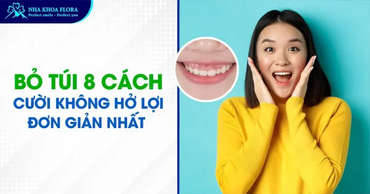 Bỏ Túi 8 Cách Cười Không Hở Lợi Đơn Giản Nhất 2