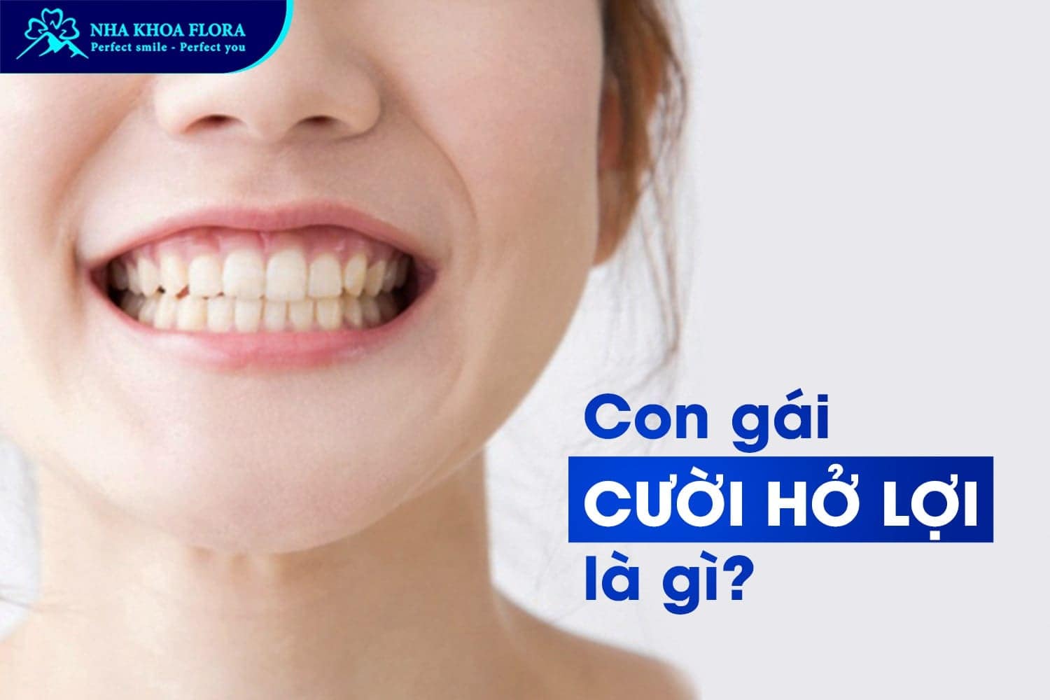 Con Gái Cười Hở Lợi Phải Làm Sao? Tướng Số Thế Nào? - ảnh 1