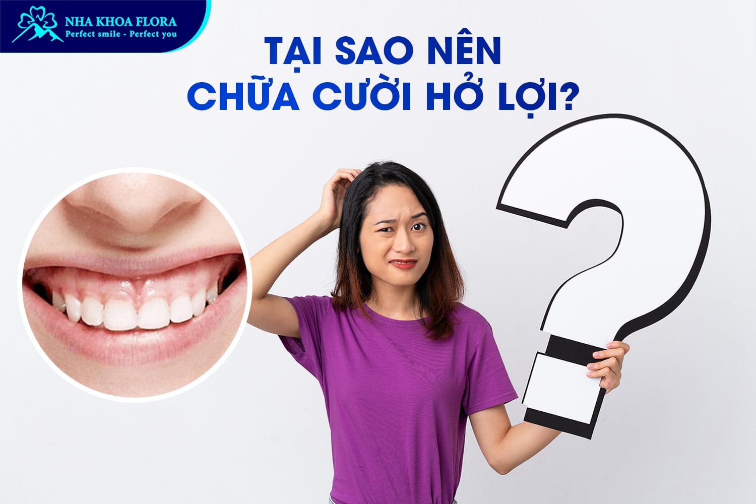 Con Gái Cười Hở Lợi Phải Làm Sao? Tướng Số Thế Nào? - ảnh 3