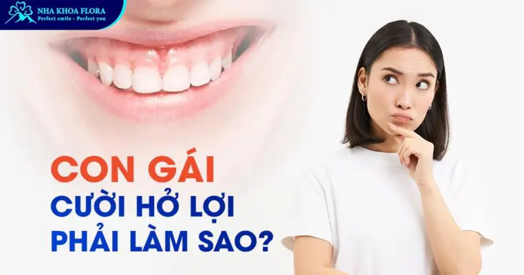 Con Gái Cười Hở Lợi Phải Làm Sao? Tướng Số Thế Nào? 4