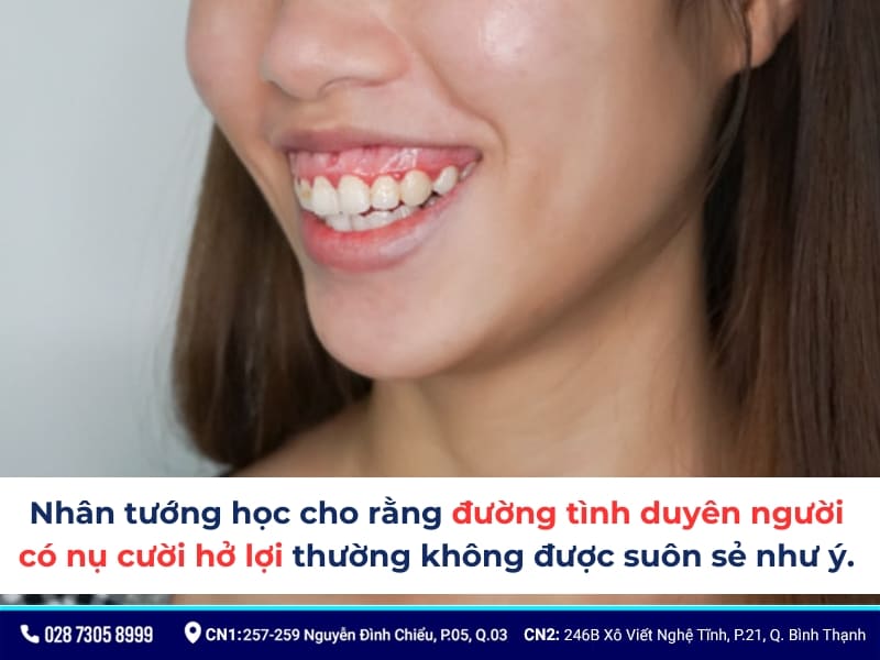 cười hở lợi thì sao