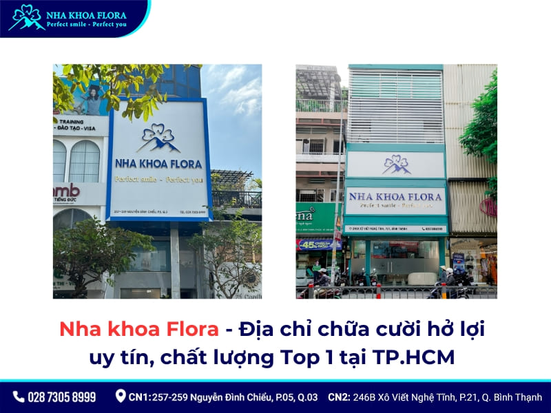 cười hở lợi thì sao