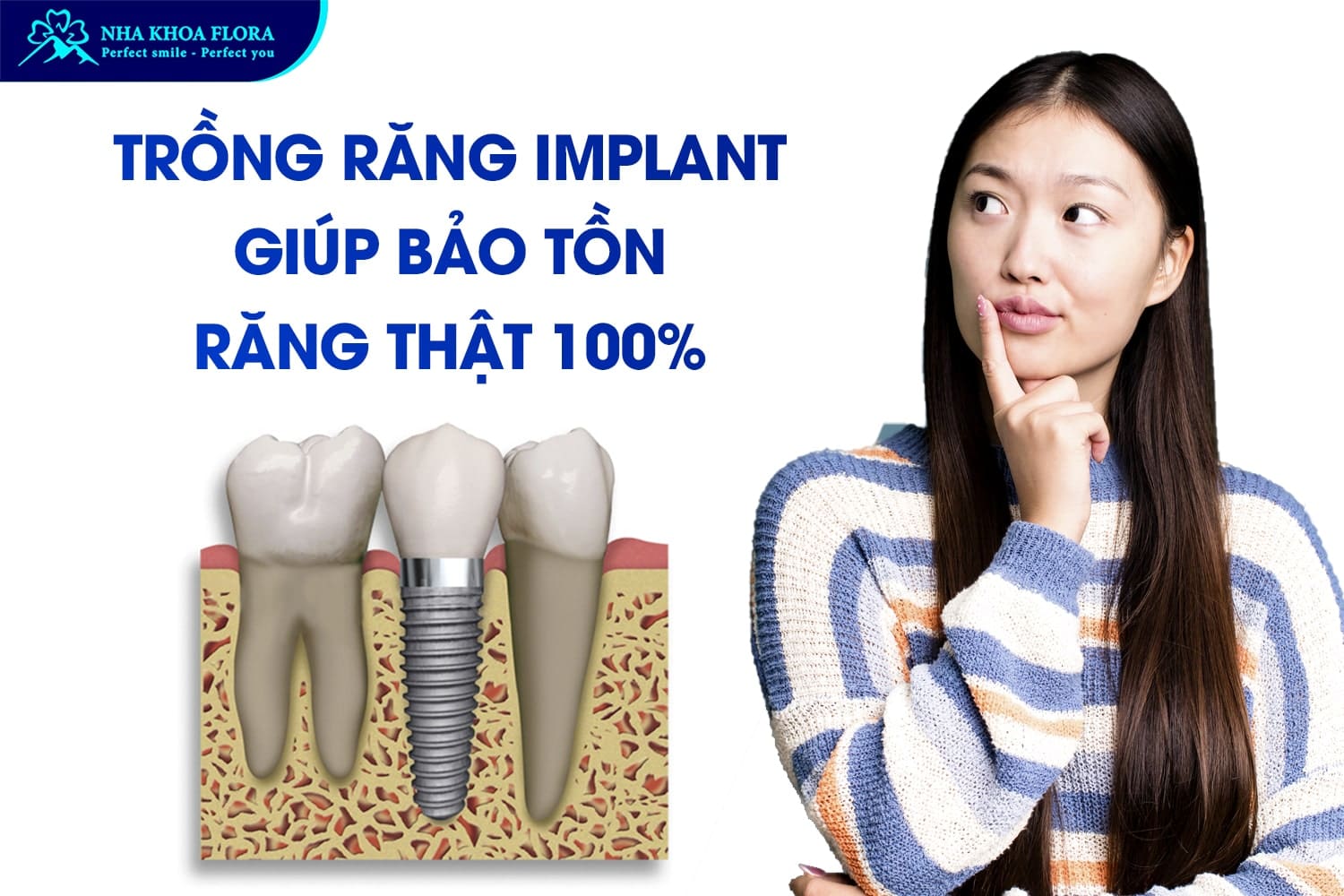 Giải Đáp Khi Nào Nên Trồng Răng Implant? - ảnh 2