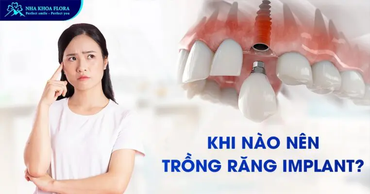 Giải Đáp Khi Nào Nên Trồng Răng Implant? 2
