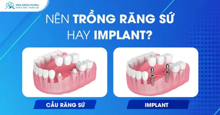 Nên Trồng Răng Sứ Hay Implant? Lựa Chọn Nào Tốt Nhất? 4