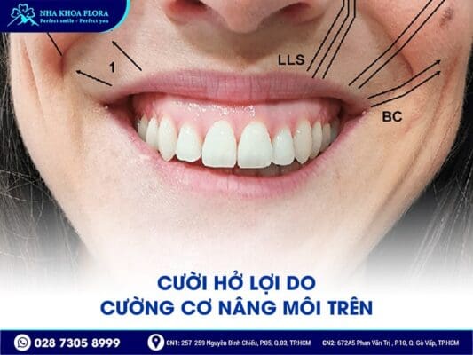 Nguyên Nhân Và Cách Khắc Phục Hiệu Quả Cười Hở Lợi 2