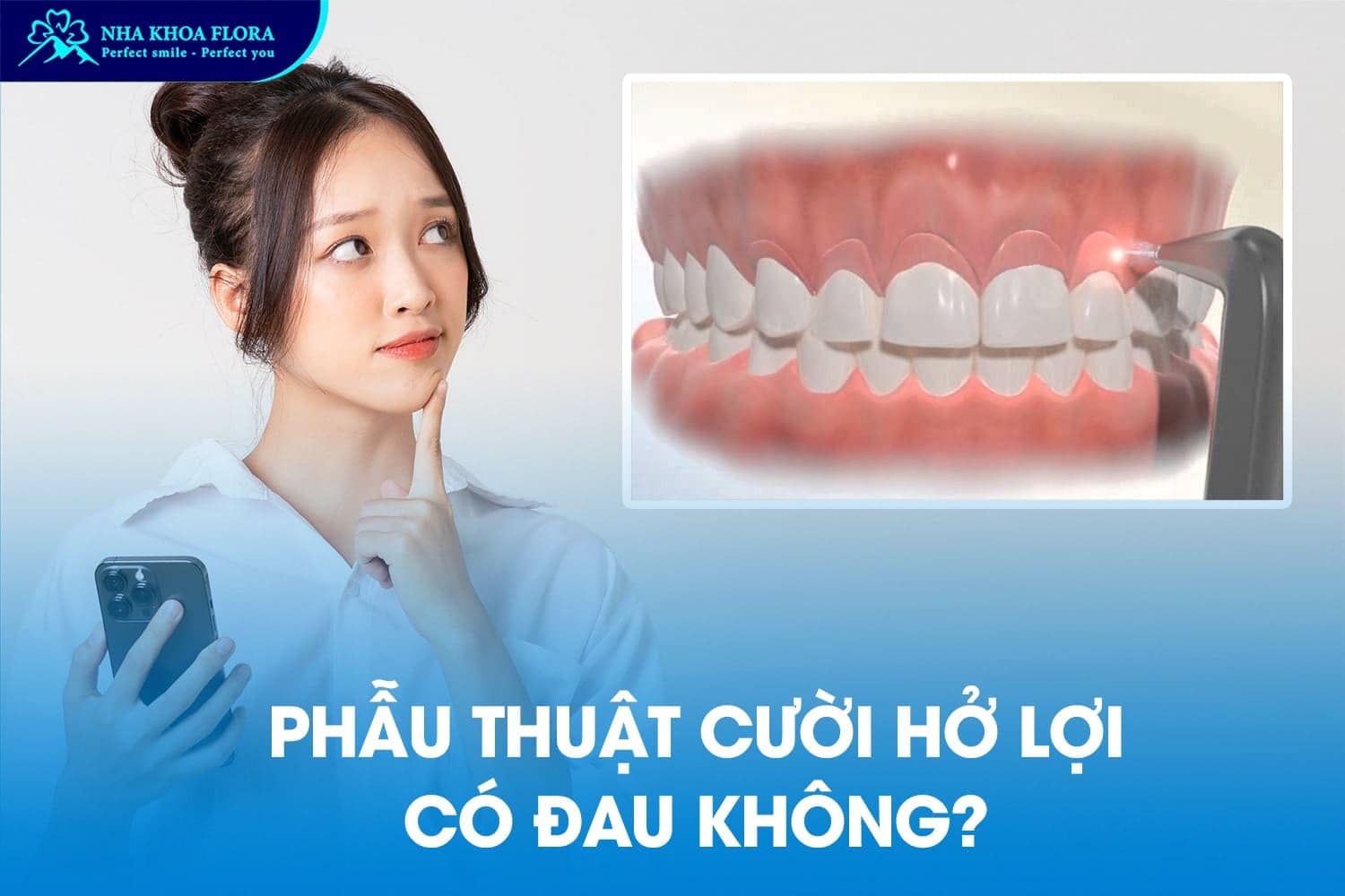 Phẫu Thuật Cười Hở Lợi Có Đau Không? Giá Bao Nhiêu? - ảnh 3