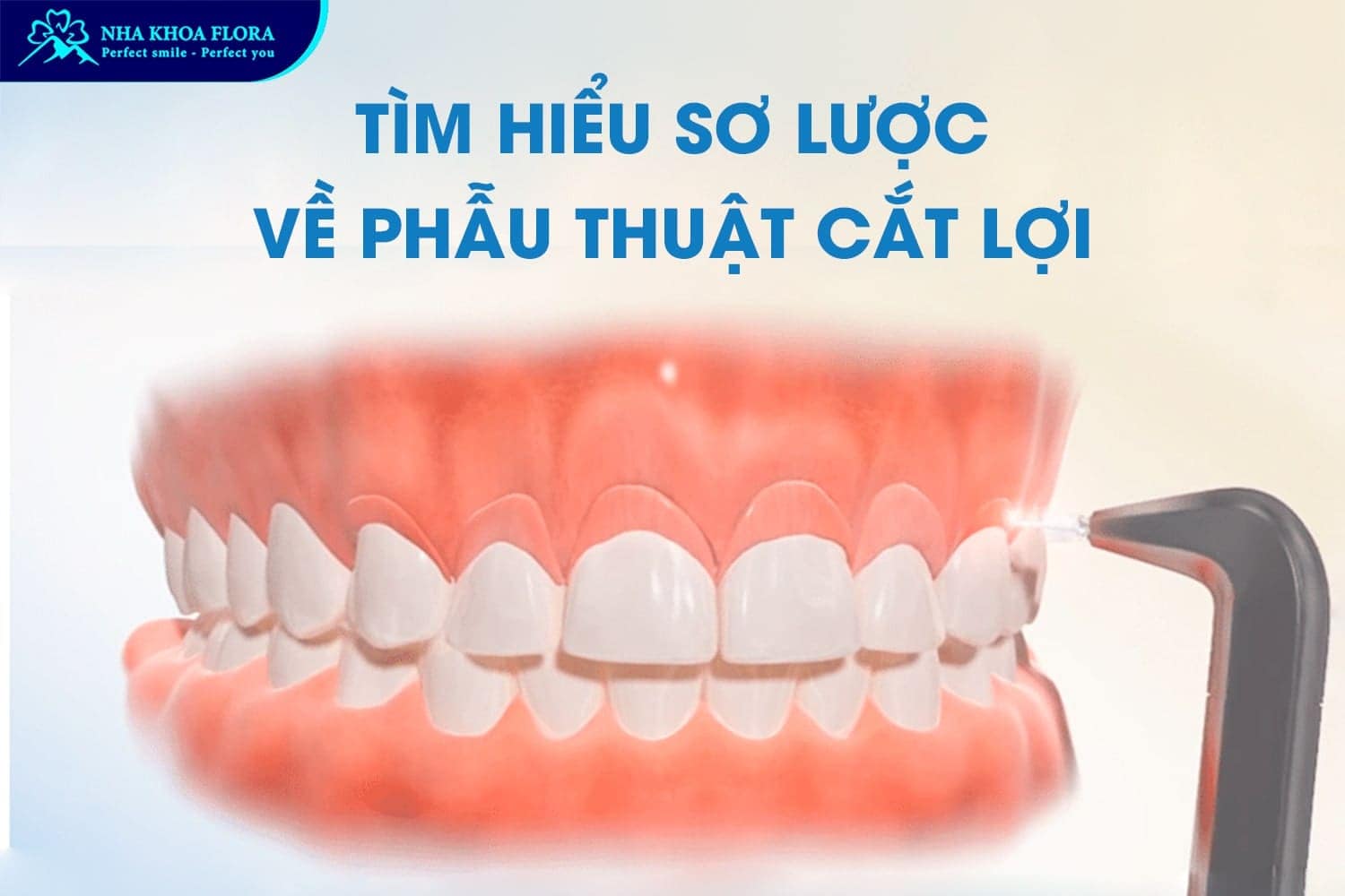 Phẫu Thuật Cười Hở Lợi Có Nguy Hiểm Không? - ảnh 1