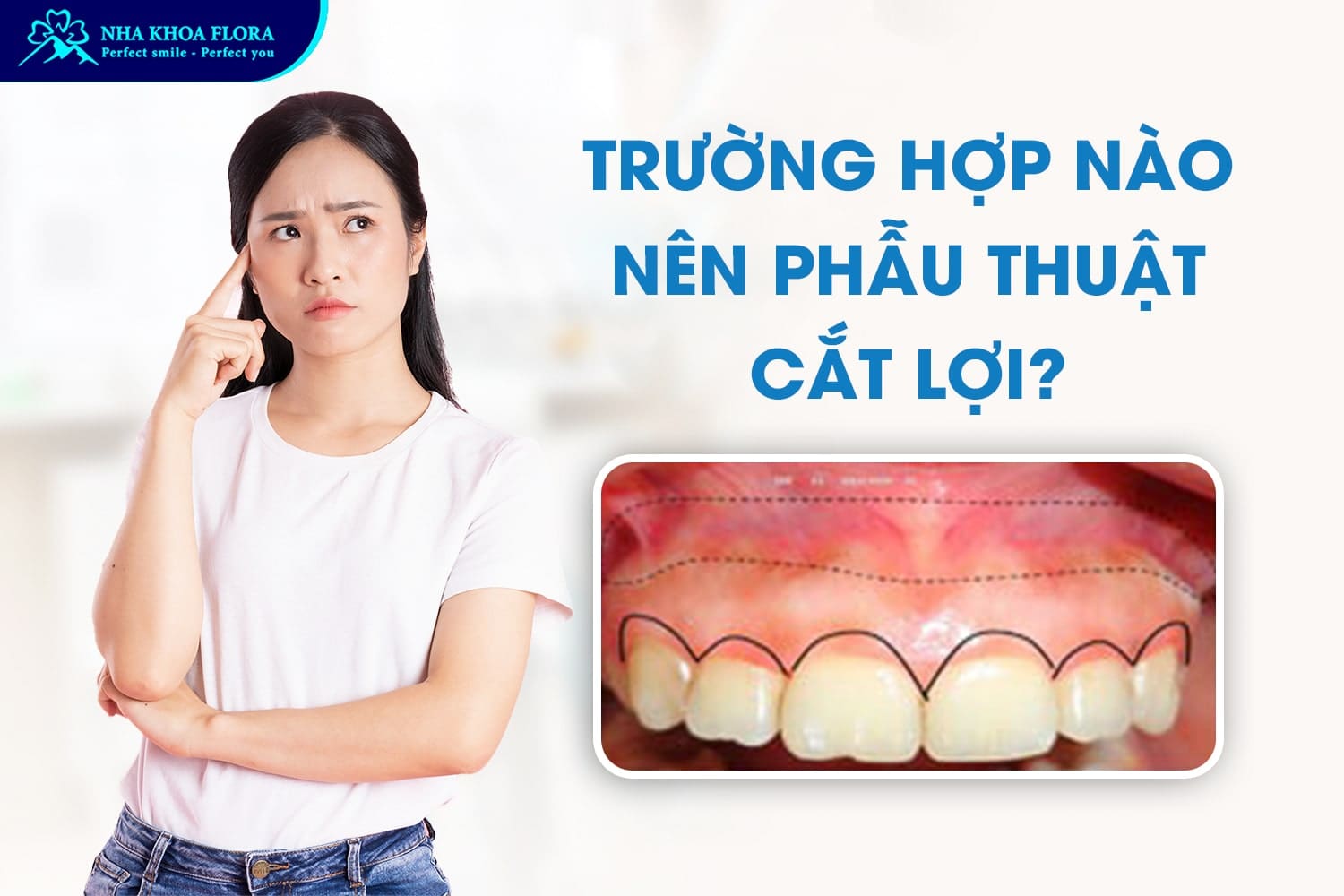 Phẫu Thuật Cười Hở Lợi Có Nguy Hiểm Không? - ảnh 2