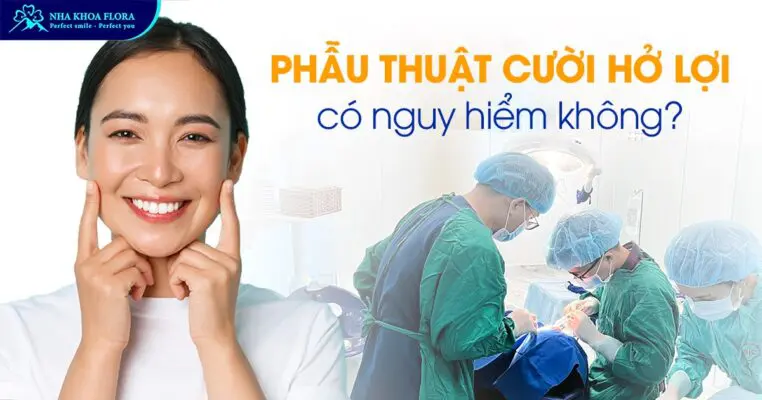 Phẫu Thuật Cười Hở Lợi Có Nguy Hiểm Không? 1