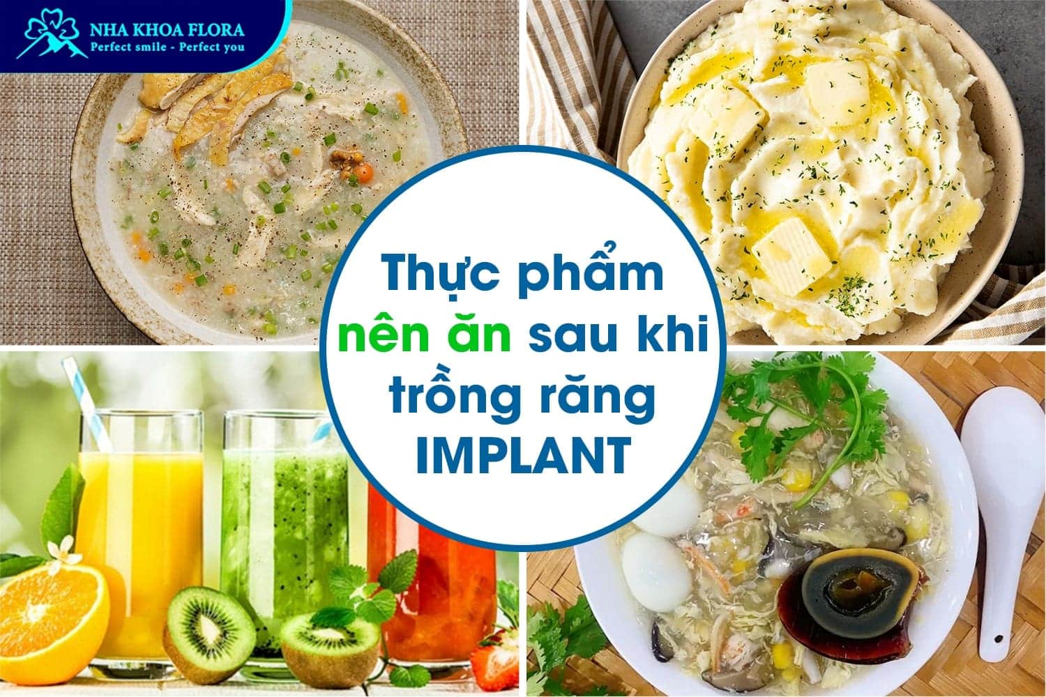 Trồng Răng Implant Bao Lâu Thì Ăn Được? - ảnh 3 Trồng Răng Implant Bao Lâu Thì Ăn Được? - ảnh 3