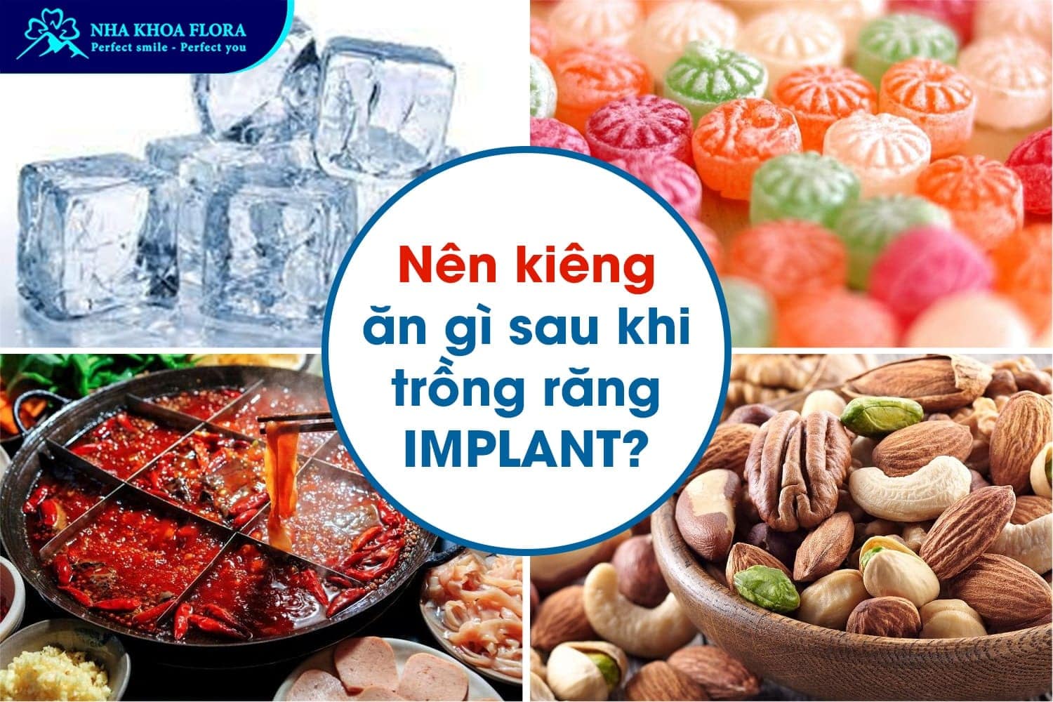 Trồng Răng Implant Bao Lâu Thì Ăn Được? - ảnh 4 Trồng Răng Implant Bao Lâu Thì Ăn Được? - ảnh 4