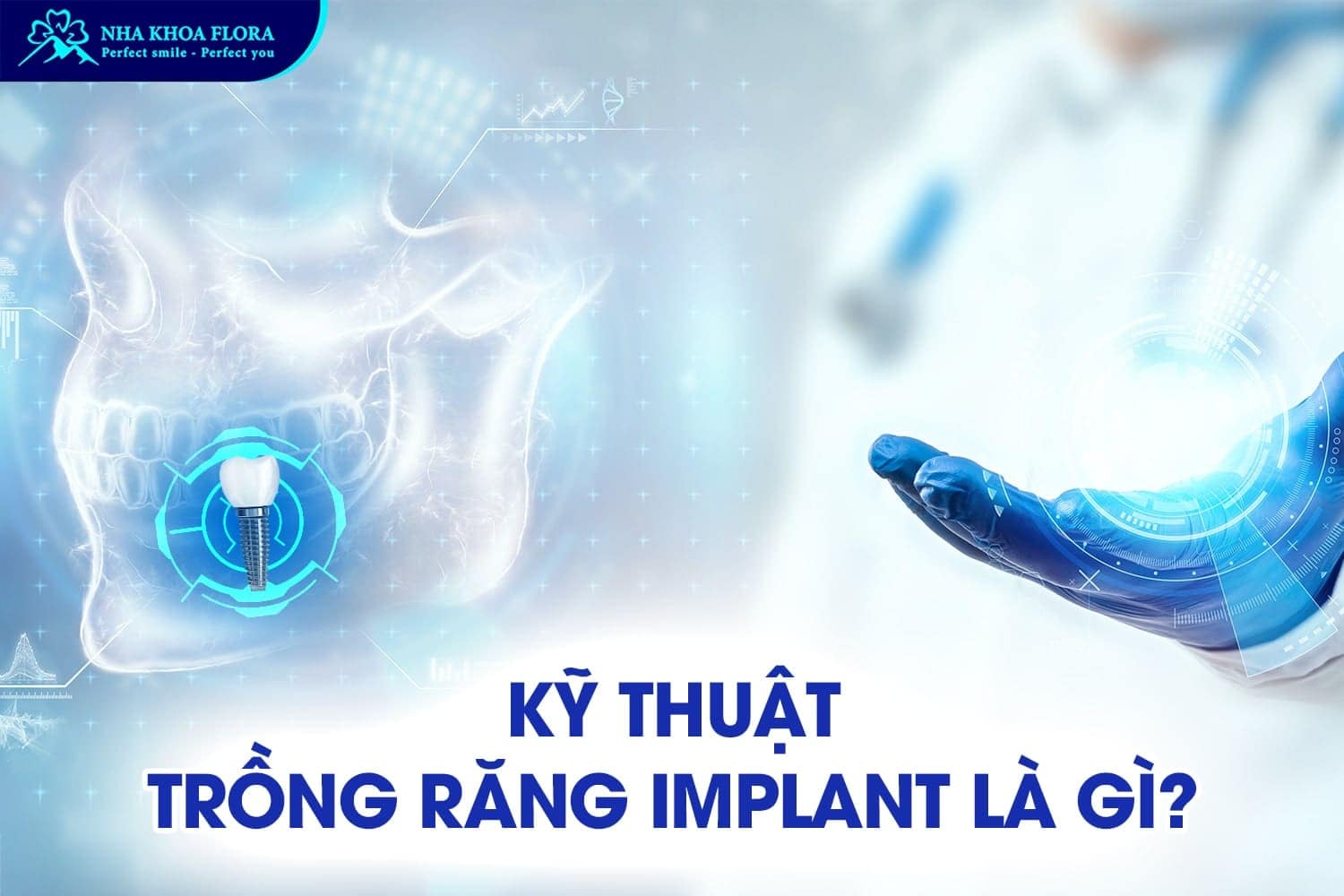 Trồng Răng Implant Giá Bao Nhiêu? - ảnh 1