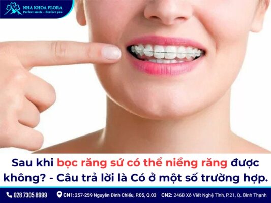bọc răng sứ có niềng được không - ảnh 1