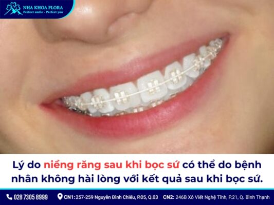 bọc răng sứ có niềng được không - ảnh 2