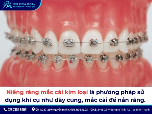 bọc răng sứ có niềng được không - ảnh 4