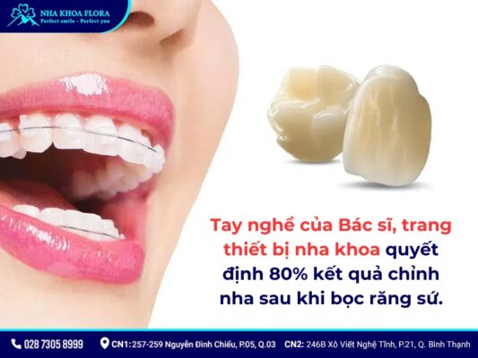 bọc răng sứ có niềng được không - ảnh 7