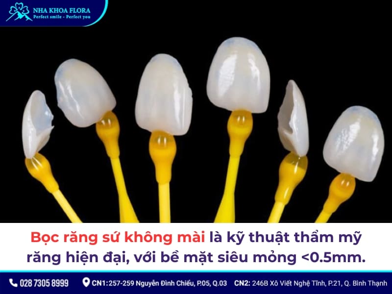 bọc răng sứ không mài