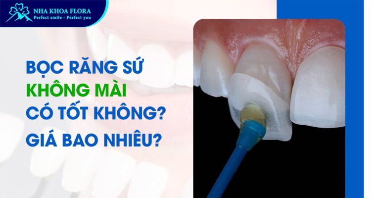 bọc răng sứ không mài