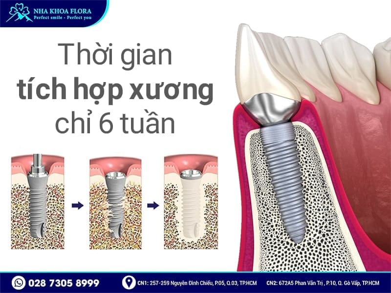 Implantswiss Thụy Sĩ - ảnh 2