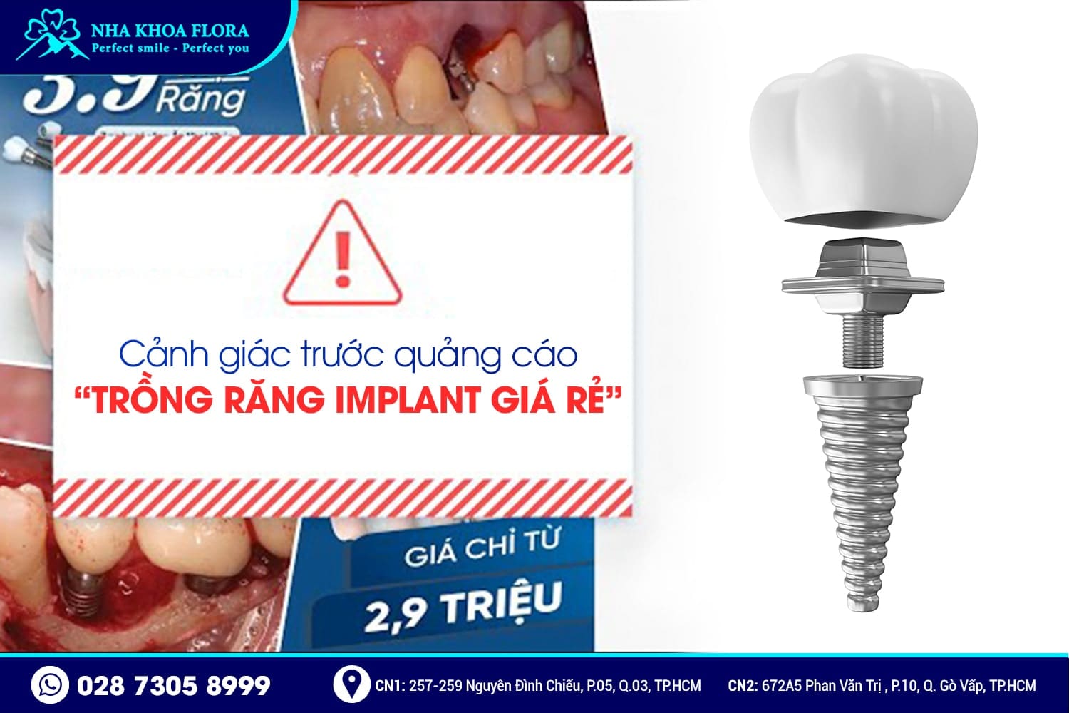 Kiều Bào về nước trồng răng Implant cần lưu ý gì? - ảnh 4 Kiều Bào về nước trồng răng Implant cần lưu ý gì? - ảnh 4
