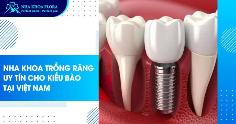 Nha khoa trồng răng uy tín cho Kiều Bào tại Việt Nam 1