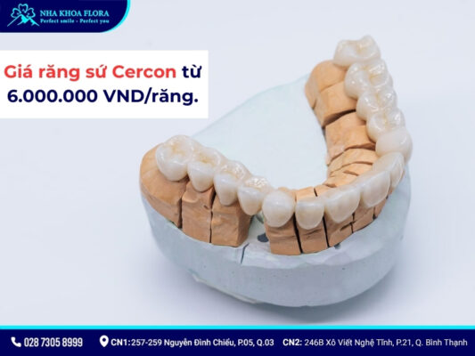 răng sứ Cercon - ảnh 4