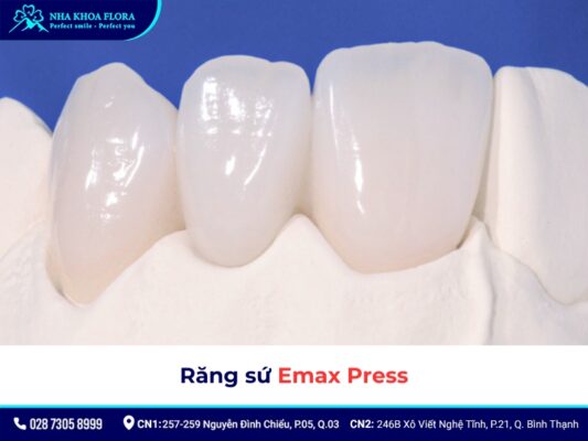 răng sứ Emax - ảnh 2 răng sứ Emax - ảnh 2