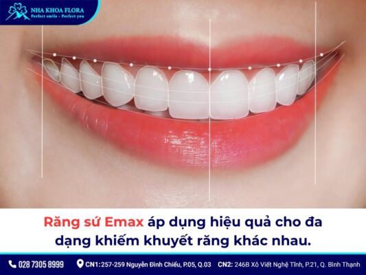 răng sứ Emax - ảnh 7 răng sứ Emax - ảnh 7