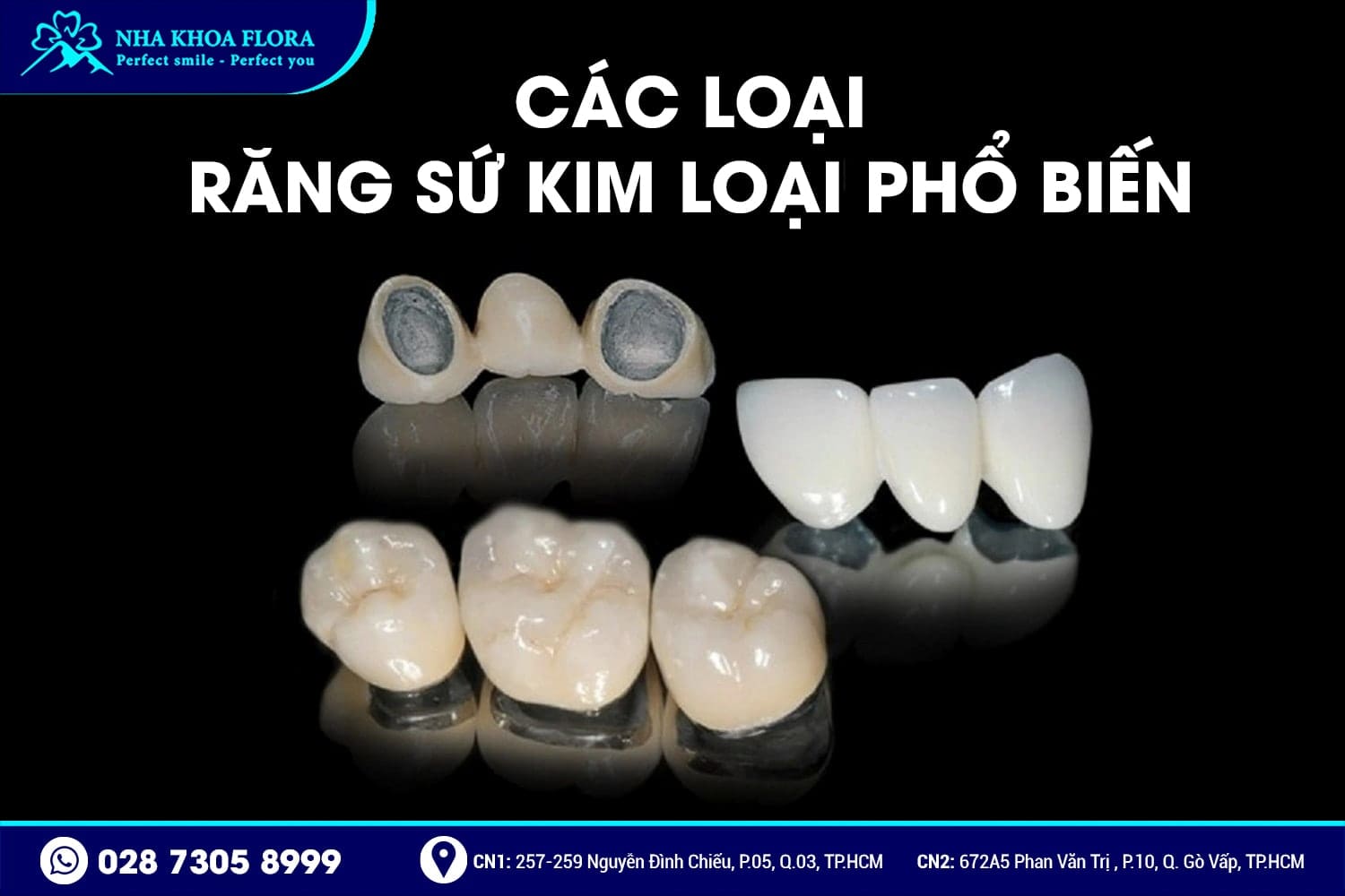 Răng Sứ Kim Loại Là Gì? Có Mấy Loại? Giá Bao Nhiêu? - ảnh 2
