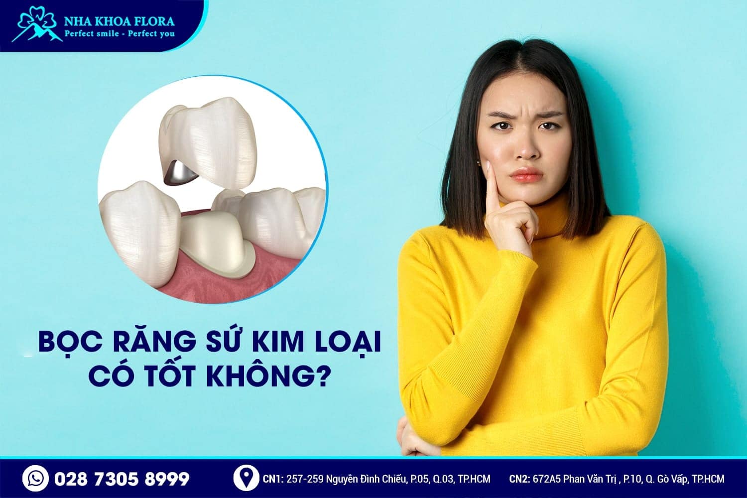 Răng Sứ Kim Loại Là Gì? Có Mấy Loại? Giá Bao Nhiêu? - ảnh 3