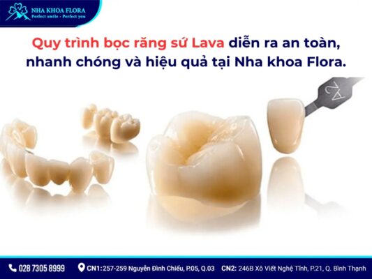 răng sứ lava - ảnh 6