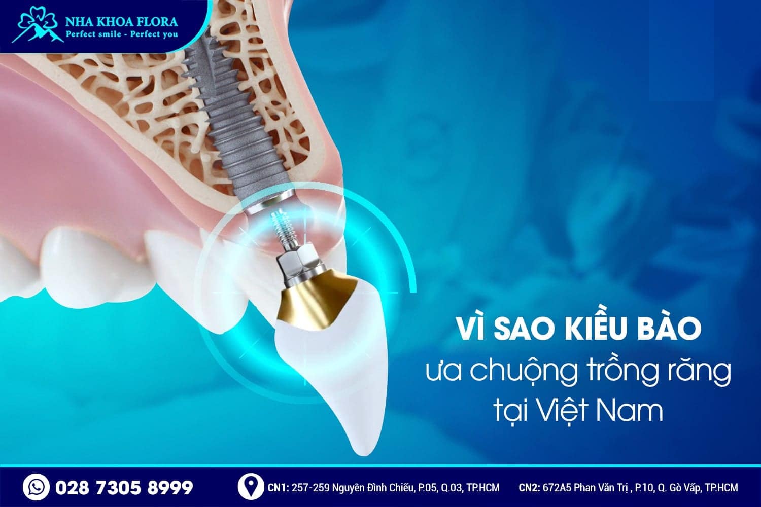 Xu hướng Kiều Bào lựa chọn trồng răng tại Việt Nam - ảnh 2 Xu hướng Kiều Bào lựa chọn trồng răng tại Việt Nam - ảnh 2