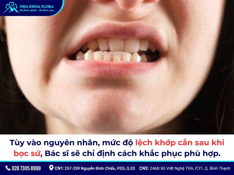 bọc răng sứ bị lệch khớp cắn