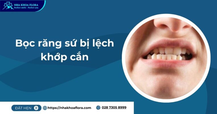 bọc răng sứ bị lệch khớp cắn