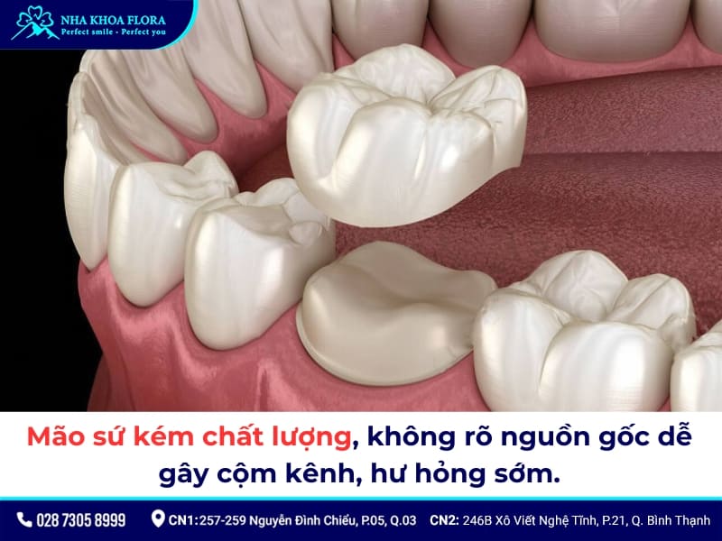 bọc răng sứ bị lệch khớp cắn