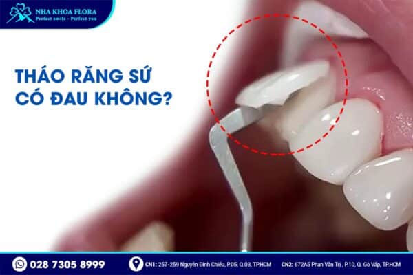 Bọc răng sứ có tháo ra được không? - ảnh 4
