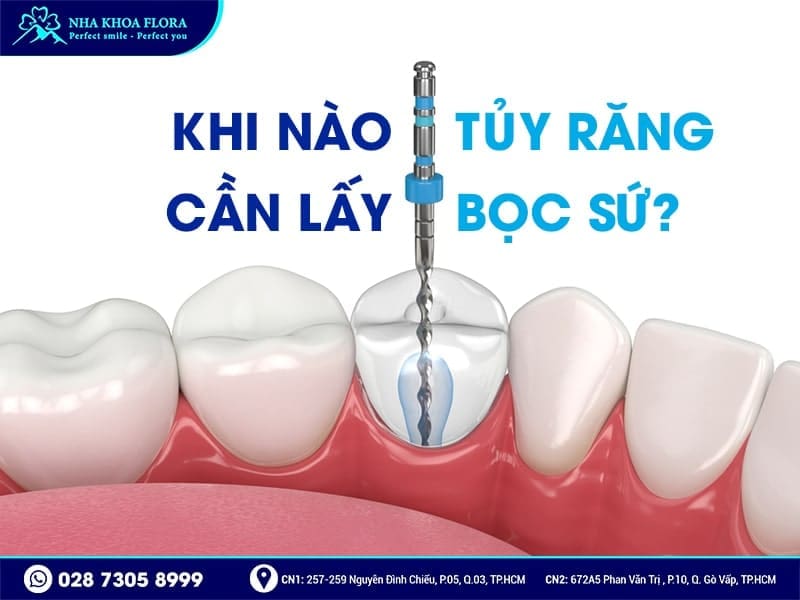 Bọc răng sứ sau khi lấy tủy - ảnh 2