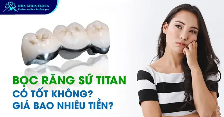 Bọc răng sứ Titan